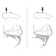 Монтажный комплект Thule 5113 для Seat Ibiza (mkIV)(5-дв. хетчбек) 2008-2017 (TH 145113)